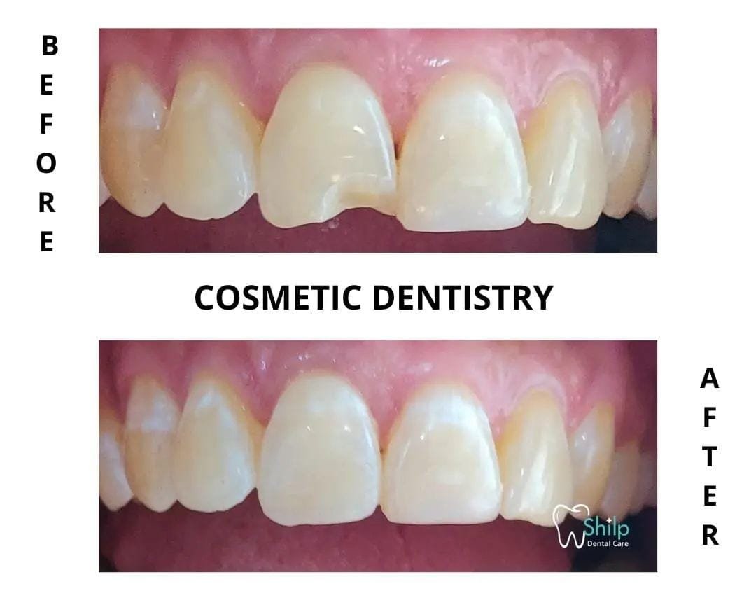 cosmetic dentistry after