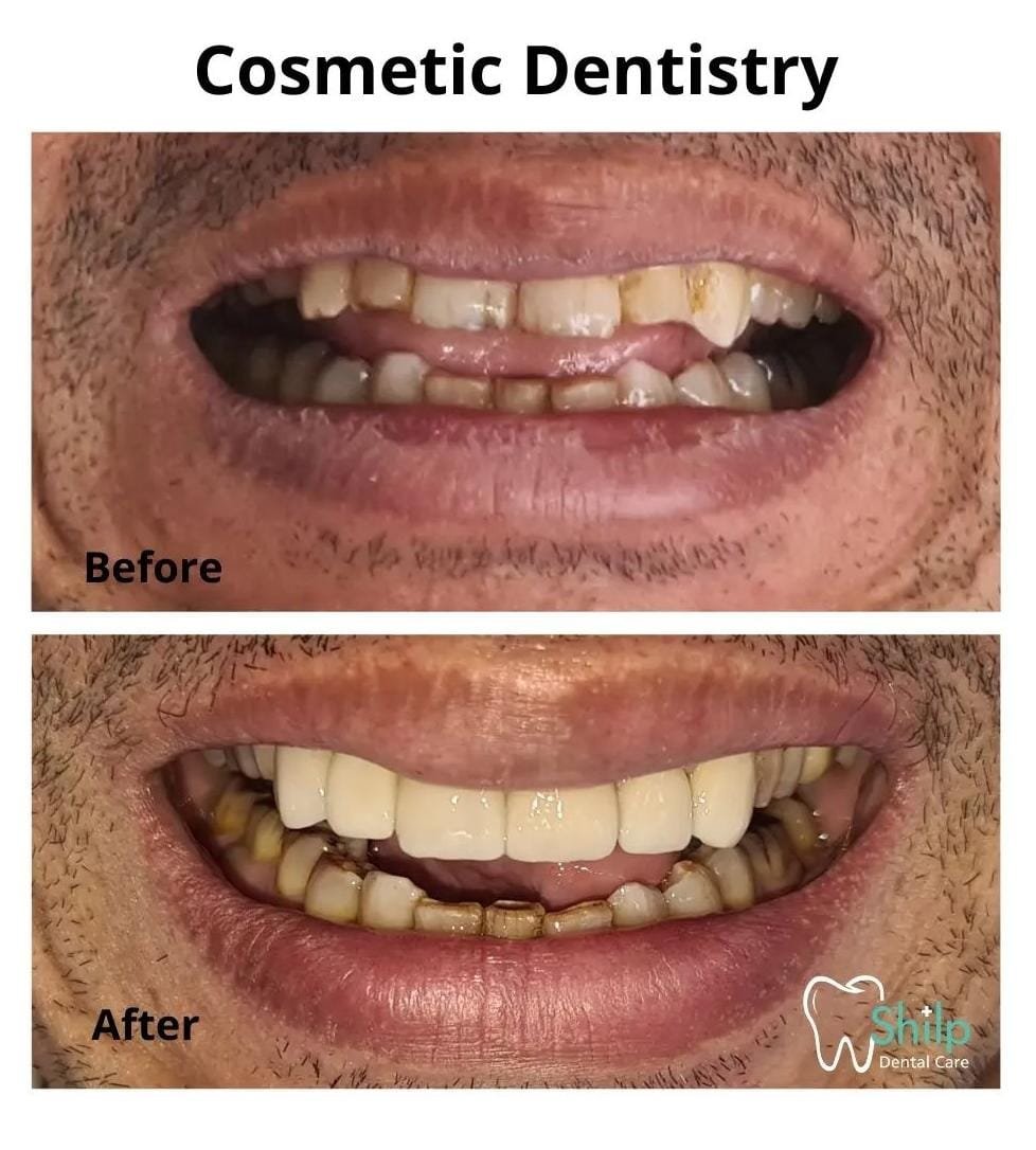 cosmetic dentistry after