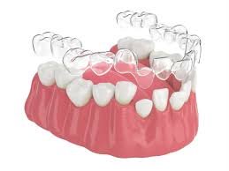 orthodontist treatments in ahmedabad