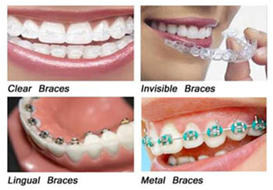 orthodontic-treatment