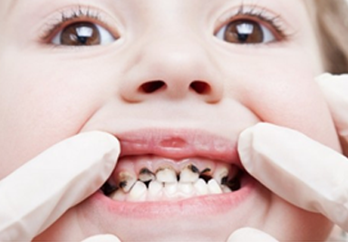 Pediatric Dentist Ahmedabad